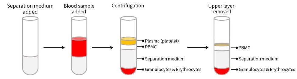 FC-200ml-Human peripheral blood lymphocyte isolation solution