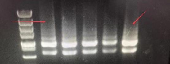 RNA Extraction Quality