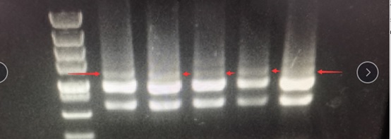 RNA Extraction Quality