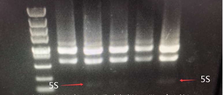 RNA Extraction Quality